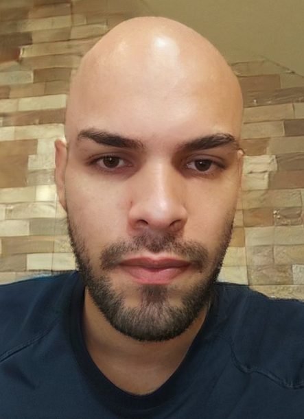 app filtro calvo